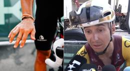 Tour de France - Bryan Coquard va continuer... avec une fracture et une attelle