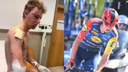 Route - Albert Withen Philipsen «bien amoché» après une chute à l'entraînement