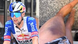 Route - Primoz Roglic percuté par une voiture et absent plusieurs semaines