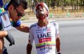 Tour Down Under Jhonatan Narvaez à l'hôpital et victime de plusieurs fractures !