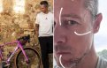 Faits Divers Nicolas Roche agressé violemment dans les rues de Barcelone